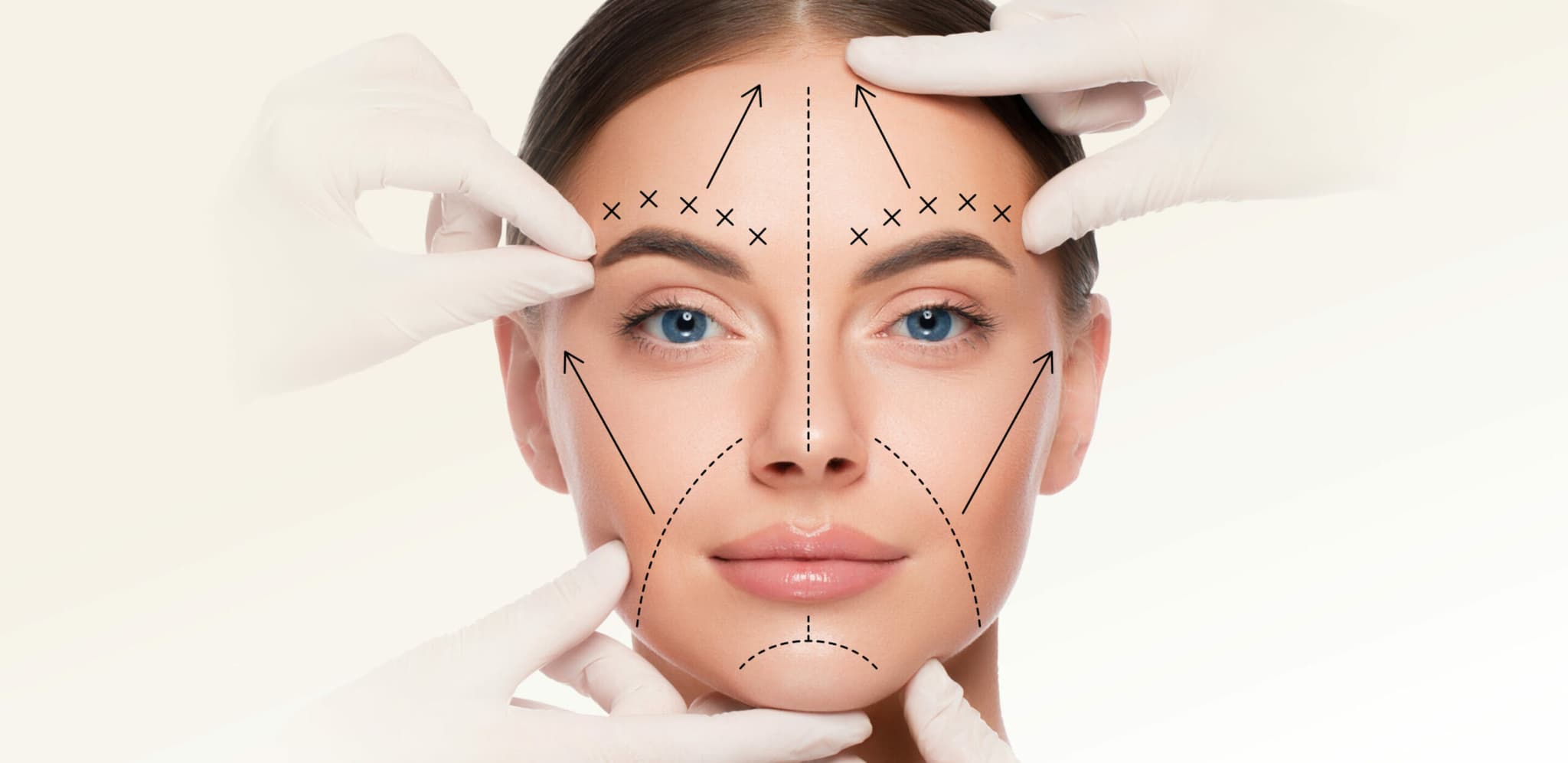 Lifting Facial